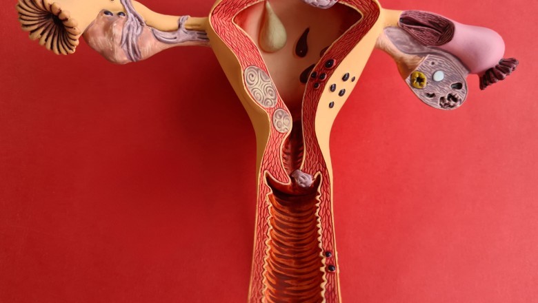 Mulher: prevenção e diagnóstico precoce são essenciais no combate ao câncer