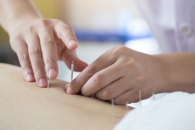 Brasil regulamenta exercício profissional da acupuntura