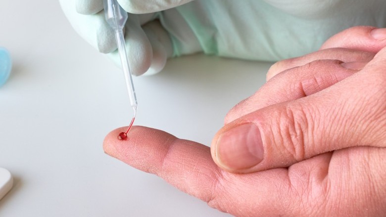 Goiás intensifica ações de prevenção às ISTs durante o Carnaval 2026